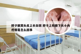 脖子腋窝头皮上长白斑 脖子上和腋下长小肉疙瘩是怎么回事