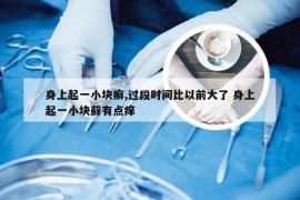 身上起一小块癣,过段时间比以前大了 身上起一小块藓有点痒