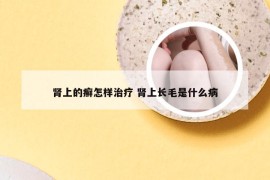 肾上的癣怎样治疗 肾上长毛是什么病