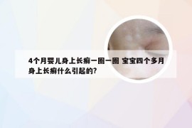 4个月婴儿身上长癣一圈一圈 宝宝四个多月身上长癣什么引起的?