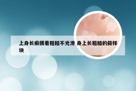 上身长癣摸着粗糙不光滑 身上长粗糙的藓样块