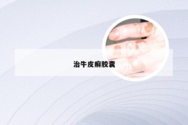 治牛皮癣胶囊