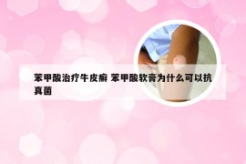 苯甲酸治疗牛皮癣 苯甲酸软膏为什么可以抗真菌