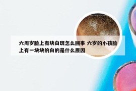 六周岁脸上有块白斑怎么回事 六岁的小孩脸上有一块块的白的是什么原因