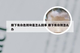 腋下有白色斑块是怎么回事 腋下有白斑怎么办