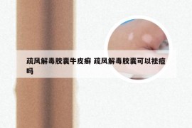 疏风解毒胶囊牛皮癣 疏风解毒胶囊可以祛痘吗