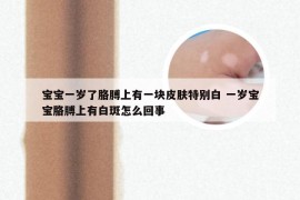 宝宝一岁了胳膊上有一块皮肤特别白 一岁宝宝胳膊上有白斑怎么回事