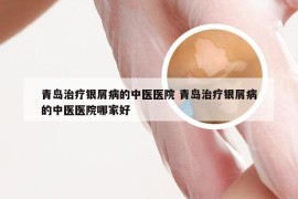 青岛治疗银屑病的中医医院 青岛治疗银屑病的中医医院哪家好