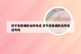 济宁皮肤病防治院电话 济宁皮肤病防治院电话号码