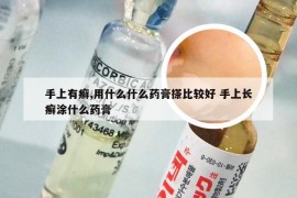手上有癣,用什么什么药膏搽比较好 手上长癣涂什么药膏