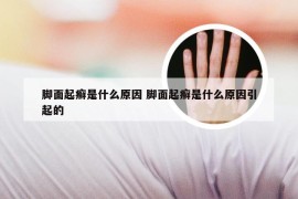 脚面起癣是什么原因 脚面起癣是什么原因引起的