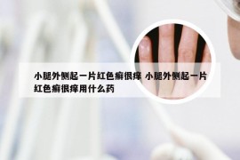 小腿外侧起一片红色癣很痒 小腿外侧起一片红色癣很痒用什么药