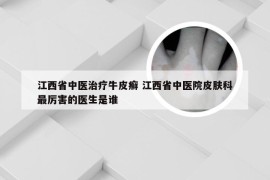 江西省中医治疗牛皮癣 江西省中医院皮肤科最厉害的医生是谁
