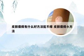 皮肤瘙痒有什么好方法能不痒 皮肤瘙痒小方法