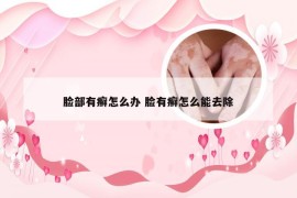 脸部有癣怎么办 脸有癣怎么能去除