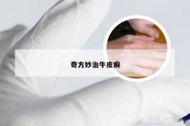 奇方妙治牛皮癣