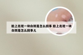 脸上出现一块白斑是怎么回事 脸上出现一块白斑是怎么回事儿