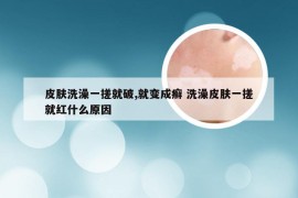 皮肤洗澡一搓就破,就变成癣 洗澡皮肤一搓就红什么原因