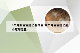 6个月的宝宝腿上有白点 六个月宝宝腿上起小疙瘩无色