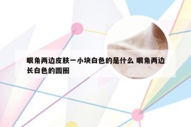 眼角两边皮肤一小块白色的是什么 眼角两边长白色的圆圈