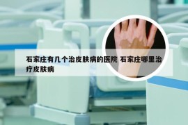 石家庄有几个治皮肤病的医院 石家庄哪里治疗皮肤病