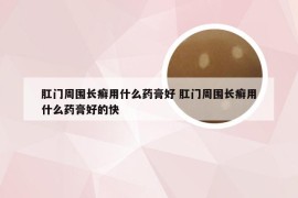 肛门周围长癣用什么药膏好 肛门周围长癣用什么药膏好的快