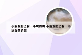 小朋友脸上有一小块白斑 小朋友脸上有一小块白色的斑