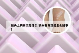 额头上的白斑是什么 额头有白斑是怎么回事?