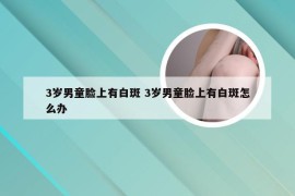 3岁男童脸上有白斑 3岁男童脸上有白斑怎么办