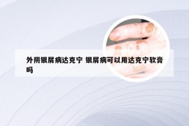 外阴银屑病达克宁 银屑病可以用达克宁软膏吗