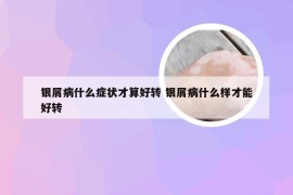 银屑病什么症状才算好转 银屑病什么样才能好转