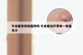 牛皮廨贵阳有医院吗 牛皮廨治疗费用一般是多少