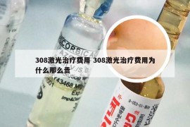 308激光治疗费用 308激光治疗费用为什么那么贵