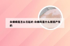 白癞癜是怎么引起的 白癞风是什么原因产生的