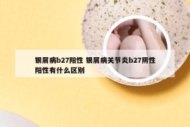 银屑病b27阳性 银屑病关节炎b27阴性阳性有什么区别