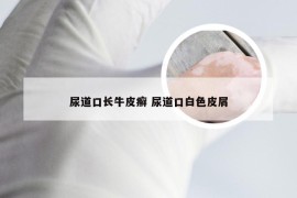 尿道口长牛皮癣 尿道口白色皮屑