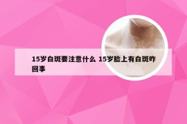 15岁白斑要注意什么 15岁脸上有白斑咋回事
