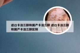 进口卡泊三醇和国产卡泊三醇 进口卡泊三醇和国产卡泊三醇区别