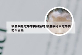 银屑病能吃牛羊肉和鱼吗 银屑病可以吃羊肉和牛肉吗