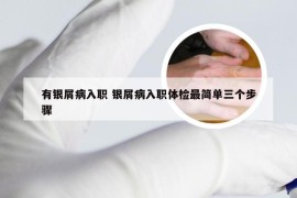有银屑病入职 银屑病入职体检最简单三个步骤