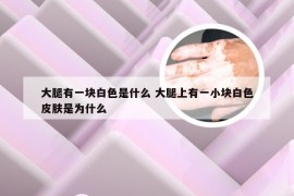 大腿有一块白色是什么 大腿上有一小块白色皮肤是为什么