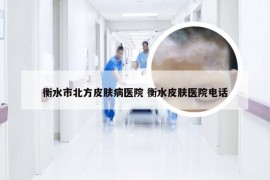 衡水市北方皮肤病医院 衡水皮肤医院电话