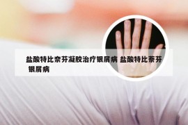 盐酸特比奈芬凝胶治疗银屑病 盐酸特比萘芬 银屑病
