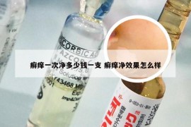 癣痒一次净多少钱一支 癣痒净效果怎么样