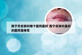 西宁市皮肤科哪个医院最好 西宁皮肤科最好的医院是哪家