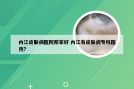 内江皮肤病医院那家好 内江有皮肤病专科医院?