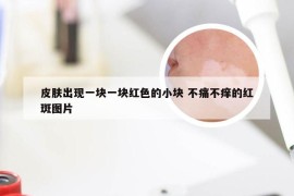 皮肤出现一块一块红色的小块 不痛不痒的红斑图片