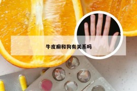 牛皮癣和狗有关系吗