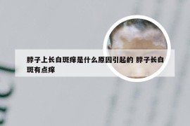 脖子上长白斑痒是什么原因引起的 脖子长白斑有点痒