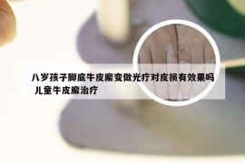 八岁孩子脚底牛皮廨变做光疗对皮损有效果吗 儿童牛皮廨治疗